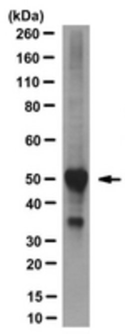 ATRX Mouse anti-Mouse, Human, Clone: 39F, MilliporeSigma 200 &mu;L | Buy Online | MilliporeSigma | Fisher Scientific
